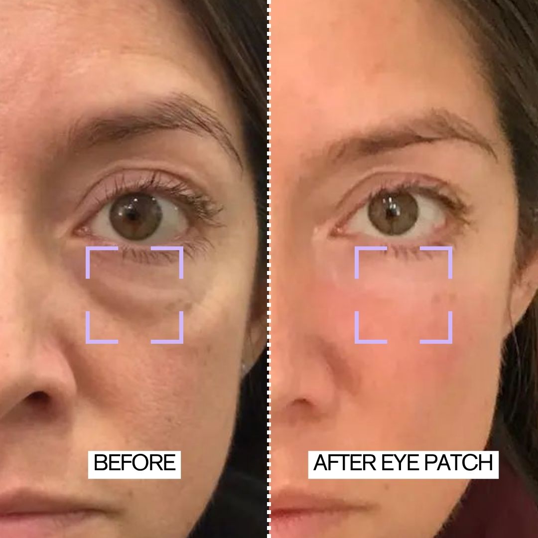 Instant Collagen Induce Firm & Tight Eye Patches | 8-PAIR PACK