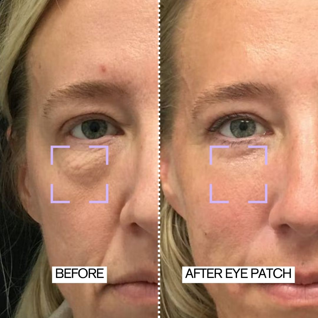 Instant Collagen Induce Firm & Tight Eye Patches | 8-PAIR PACK