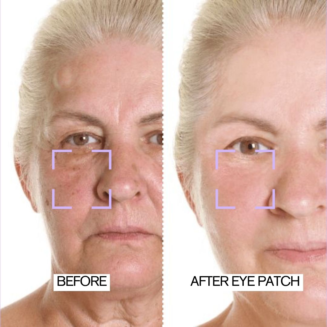 Instant Collagen Induce Firm & Tight Eye Patches | 8-PAIR PACK