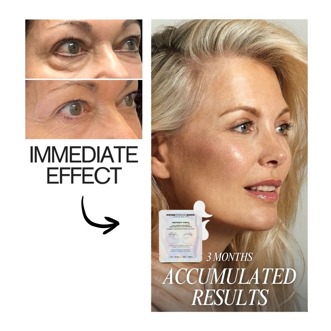 Instant Collagen Induce Firm & Tight Eye Patches | 8-PAIR PACK